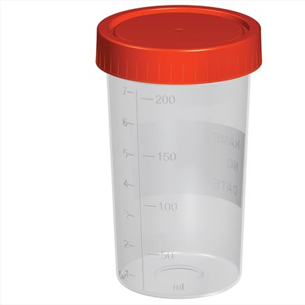 200ml Small Plastic Sample Container Pot Jar - PACK 275